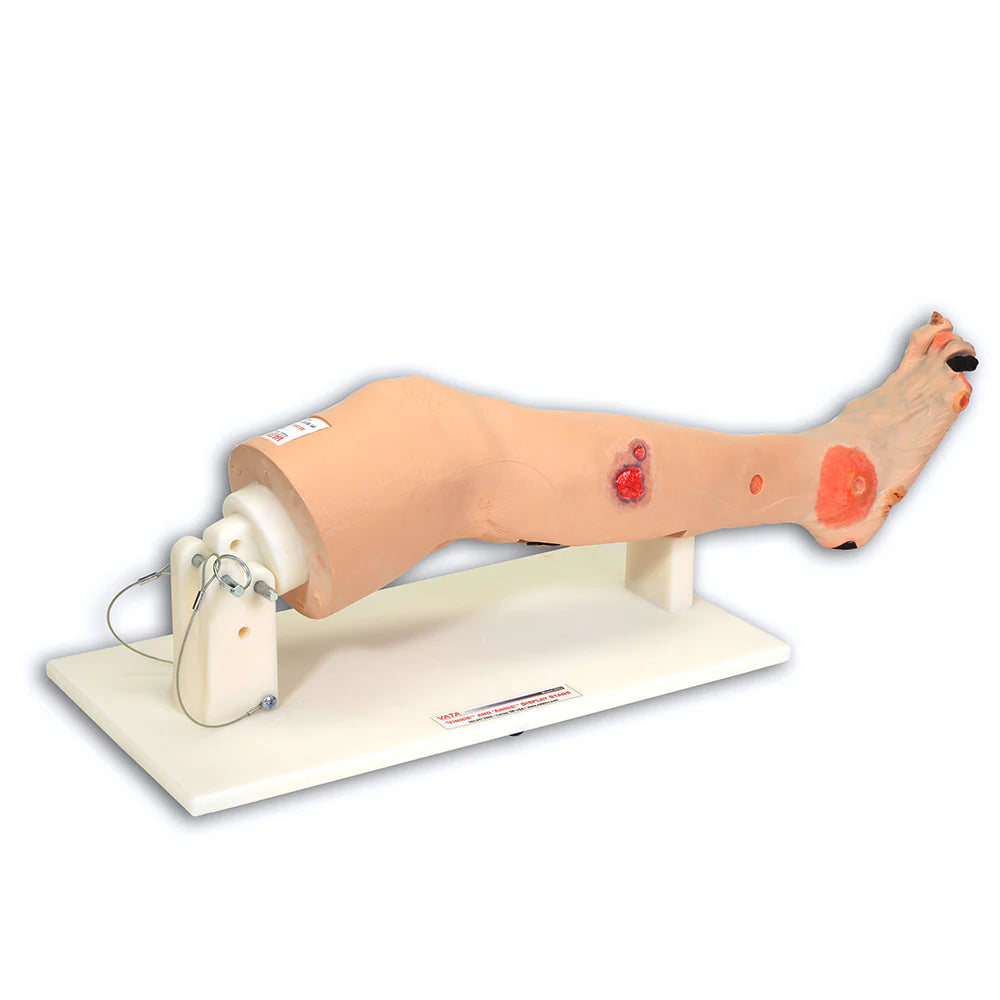 VATA0555 Annie Insufficiency Leg right side view on stand