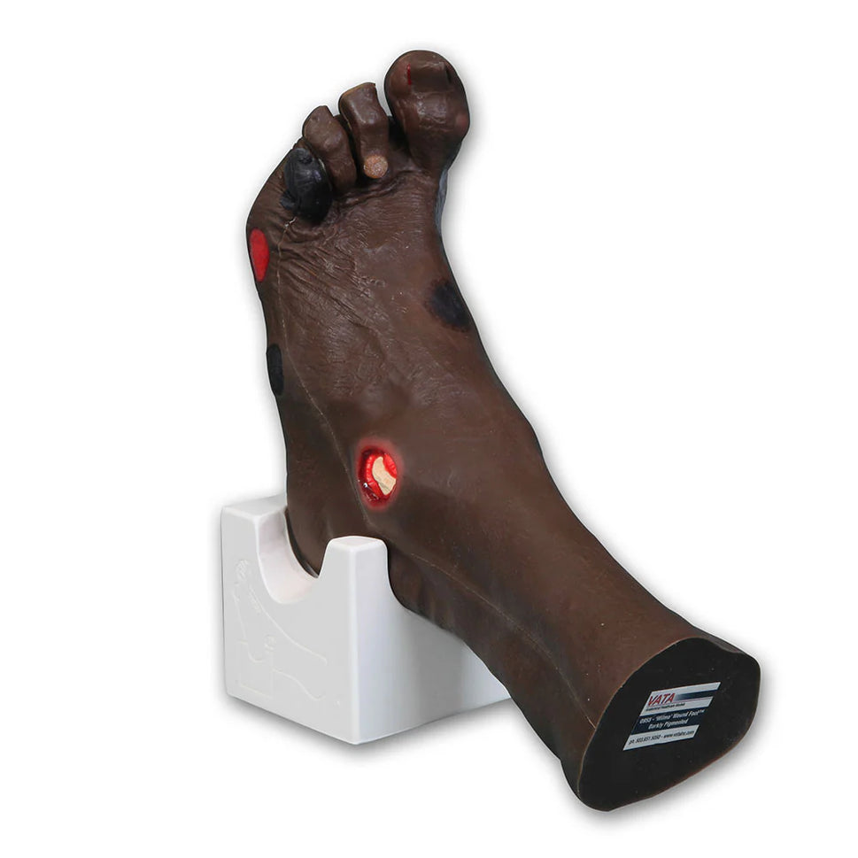 Wilma Wound Foot Trainer