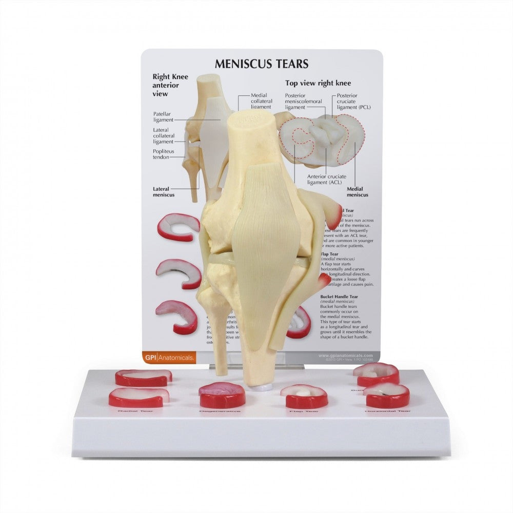 Knee Anatomy & Pathology Collection