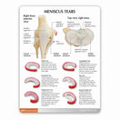 Switch Included is a two-sided information card with labelled anatomy 3 image
