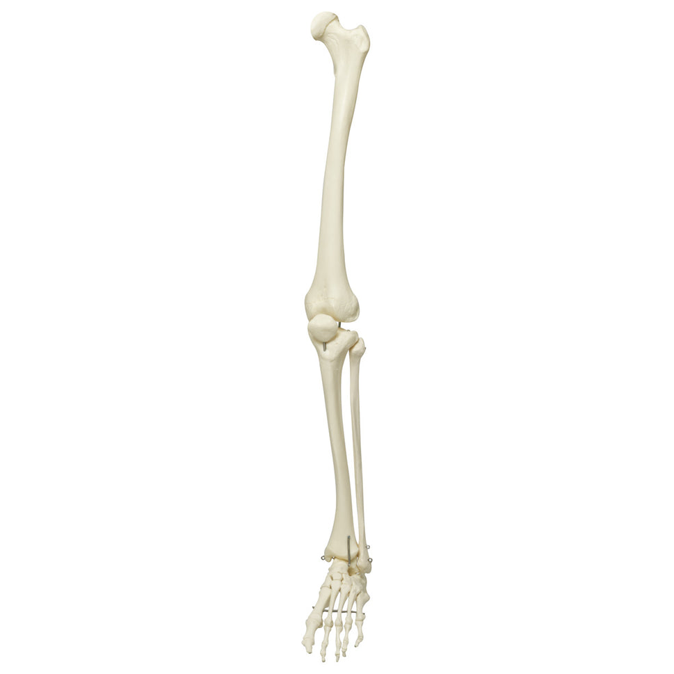 A10 Stan Replacement Leg (Left)