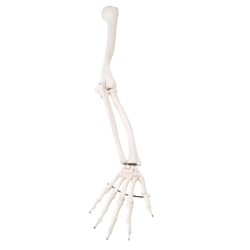 A10 Stan Replacement Arm (Right)