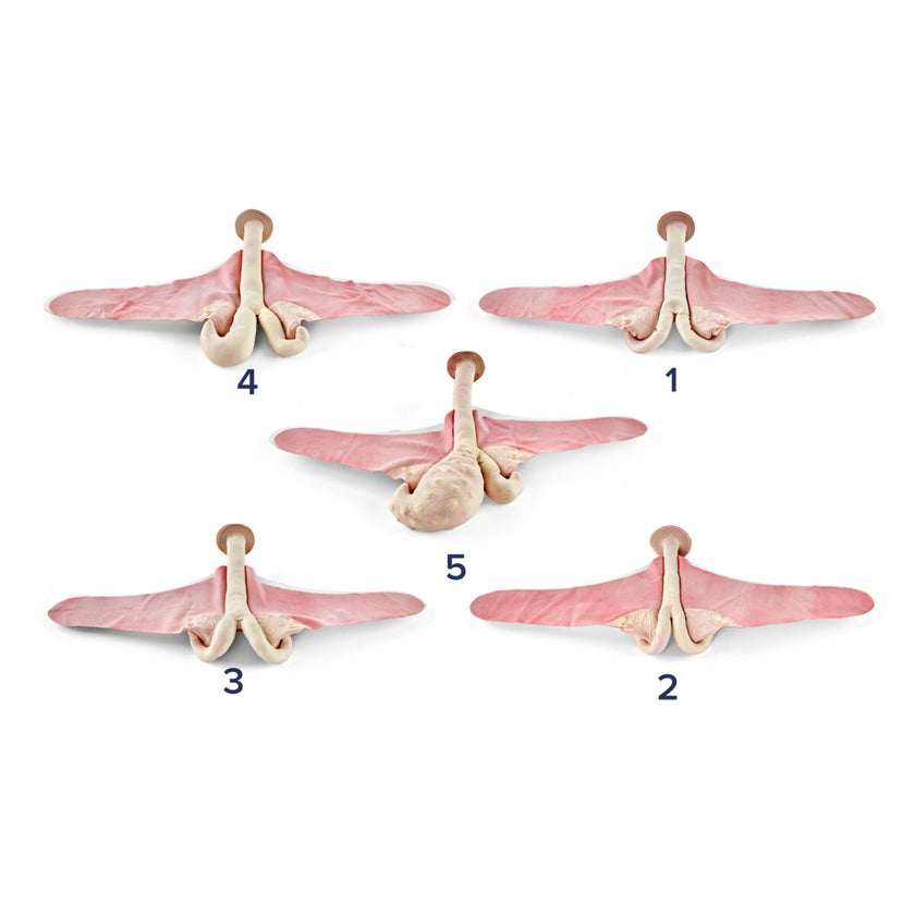 Bovine Theriogenology Uterus set (5 Part) 1025499 full set