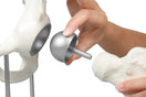 Switch Parts of the Hip Joint Model with Birmingham Hip Resurfacing 2 image