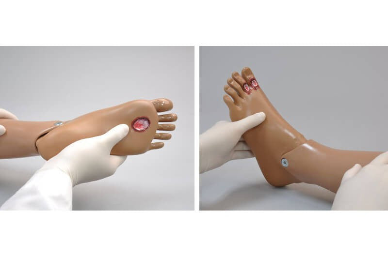 Patient Care Ulcerated Foot Option for Clinical CHLOE Advanced Nursing Patient Care Simulator