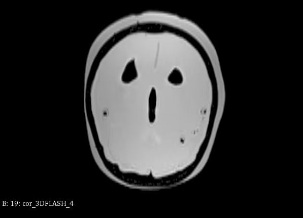 Adult Head Phantom (Standard) for X-Ray CT, US, MRI