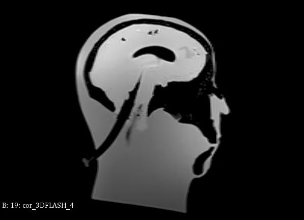 Adult Head (Standard) for X-Ray CT, US, MRI HD-A03 image 6
