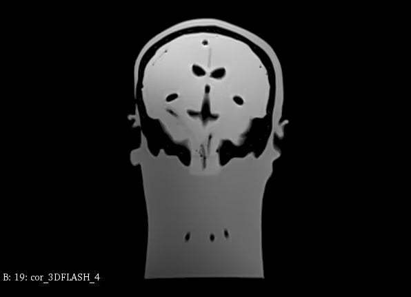 Adult Head Phantom (Standard) for X-Ray CT, US, MRI