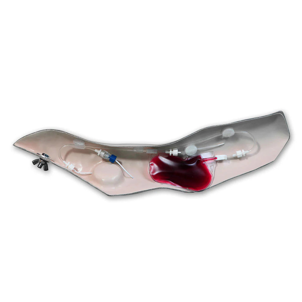 Port Access Arm For Advanced Chester Chest