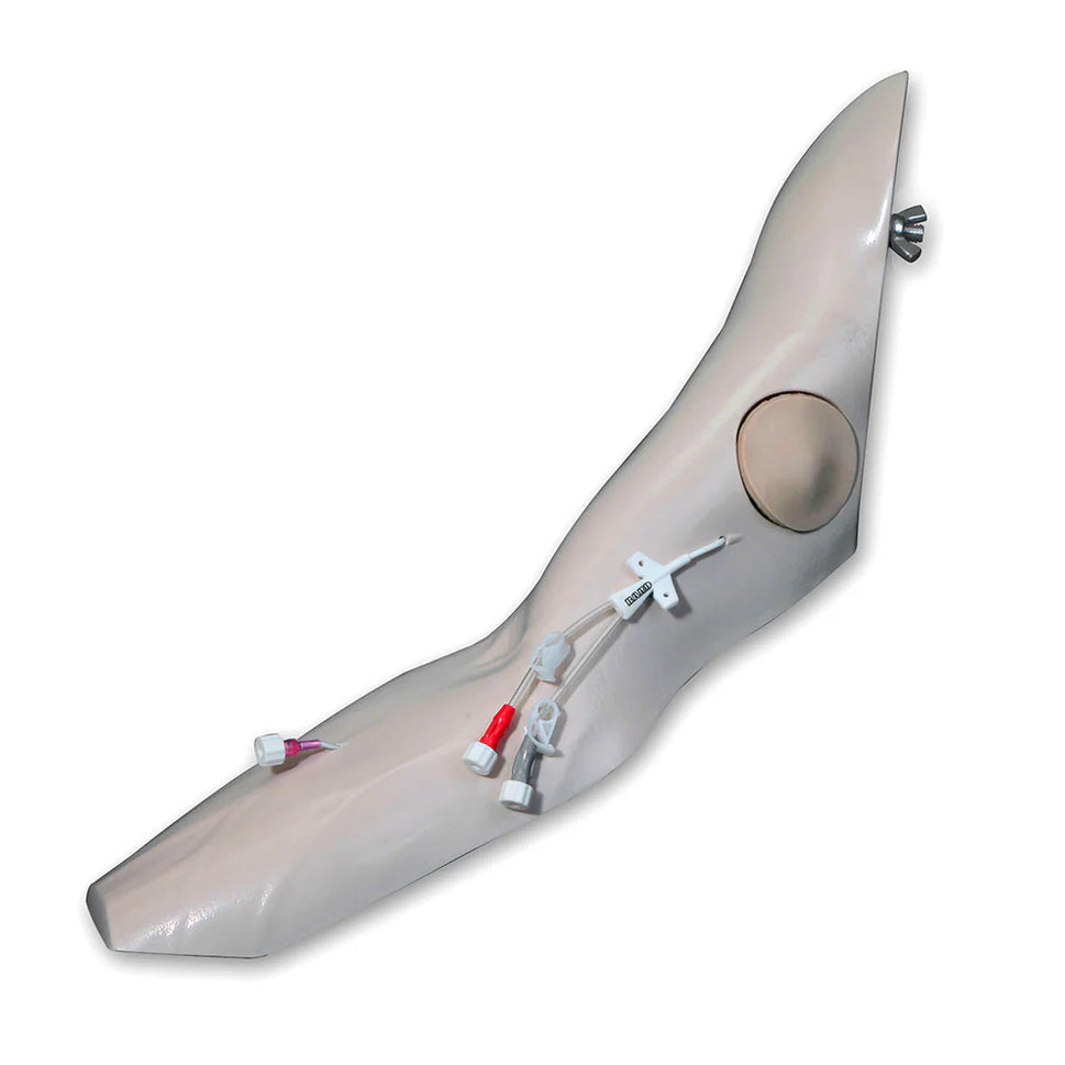 Port Access Arm For Advanced Chester Chest
