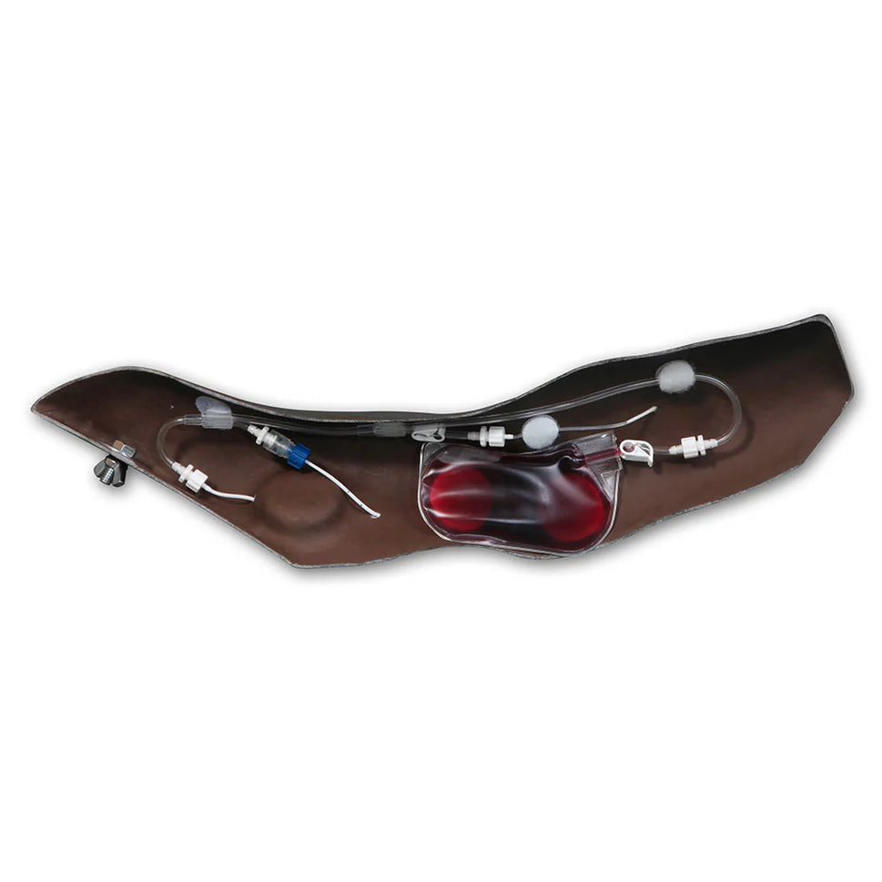 Port Access Arm For Advanced Chester Chest