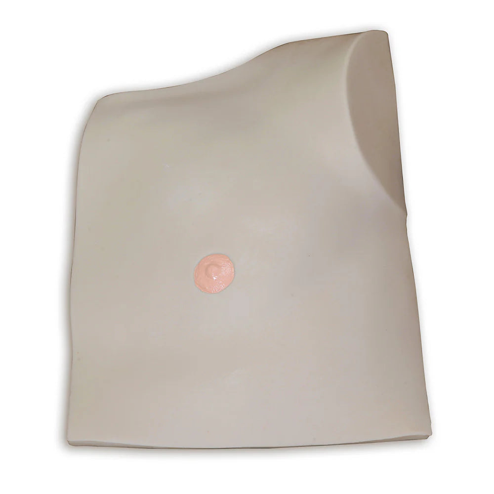 Outer Tissue Flap Replacement For Chester Chest