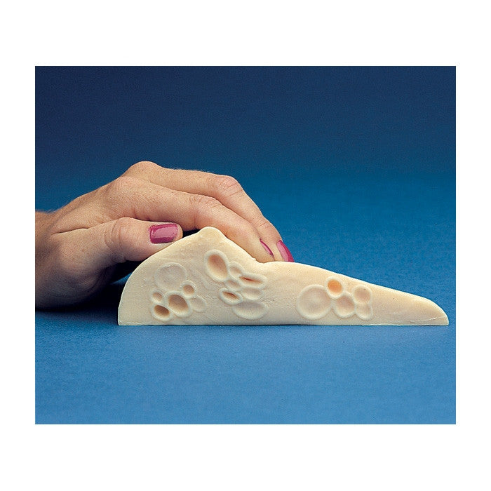 Fibrocystic BSE Model