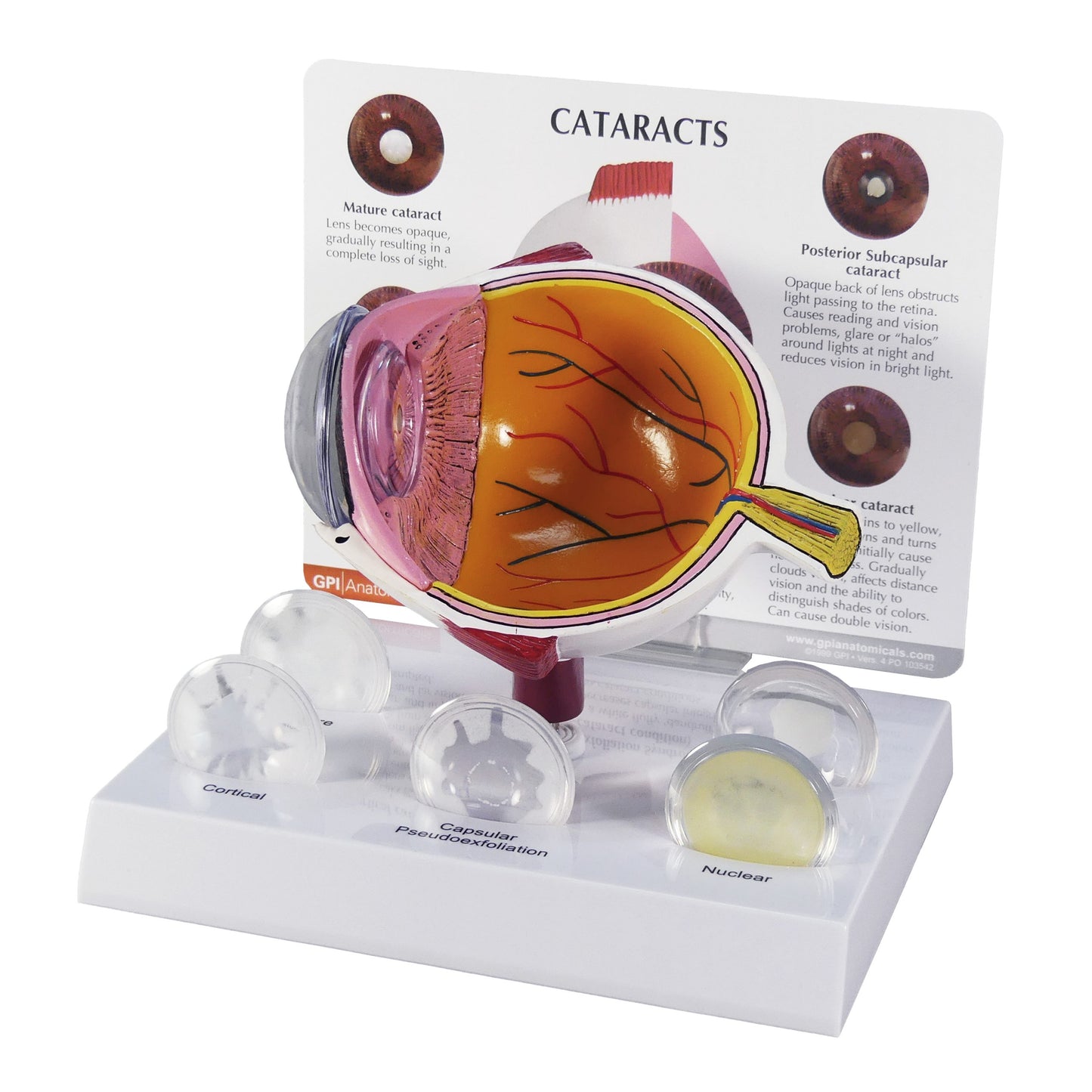 2800 Cataract Eye Model 
