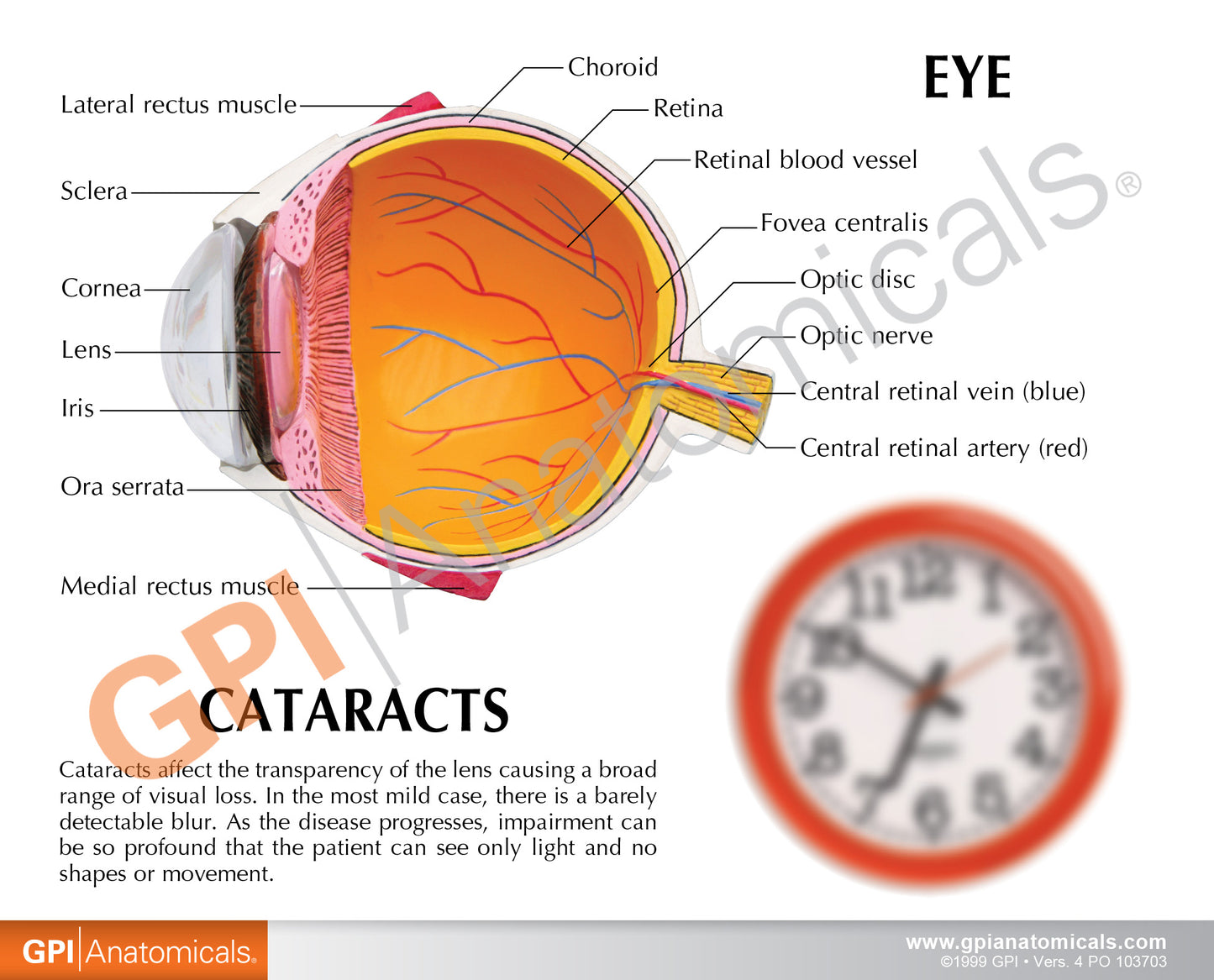 2800 Cataract Eye Model card back
