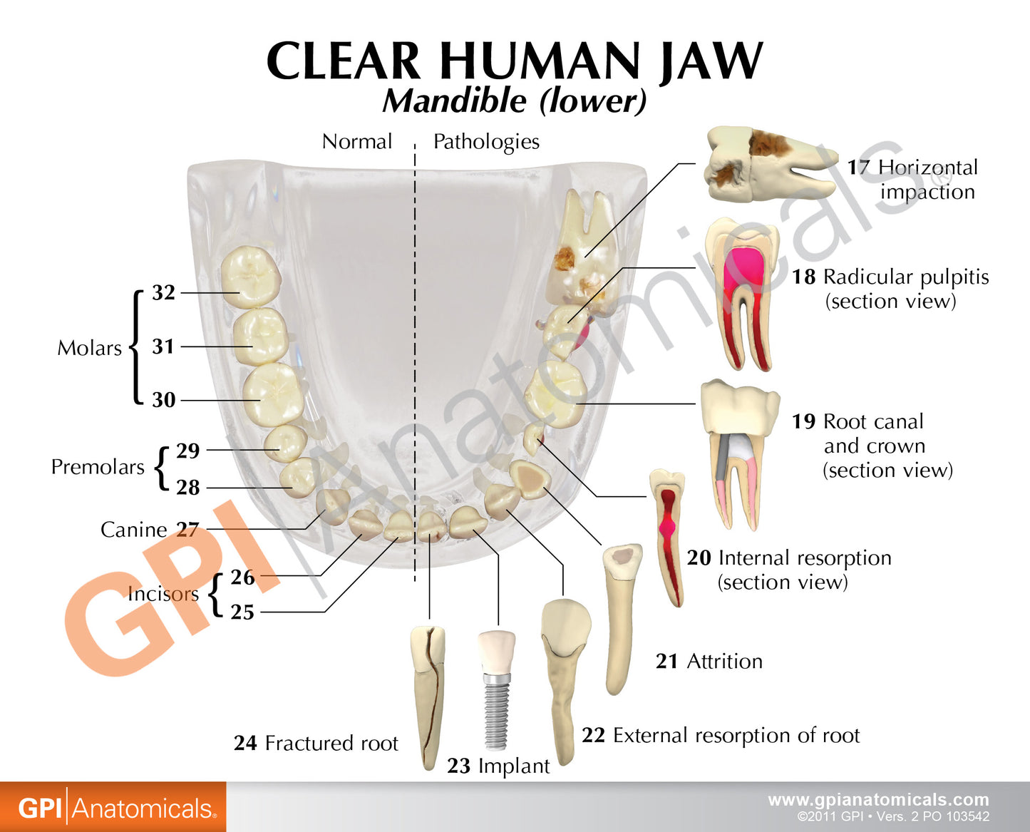 2861 Clear Human Jaw Card Front