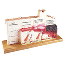 Switch Posterior aspect of the human skin series with burn pathologies model showing the different severities of burns 2 image