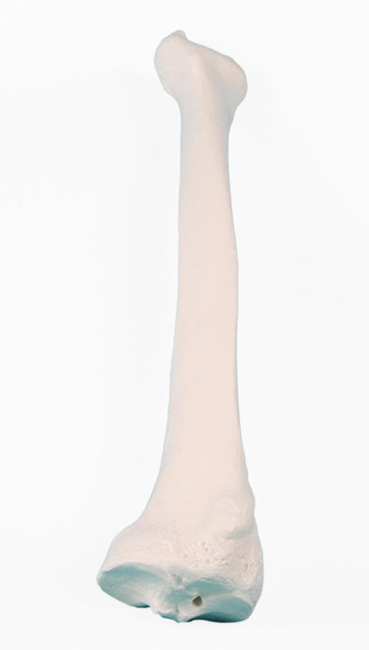 Radius Bone Model