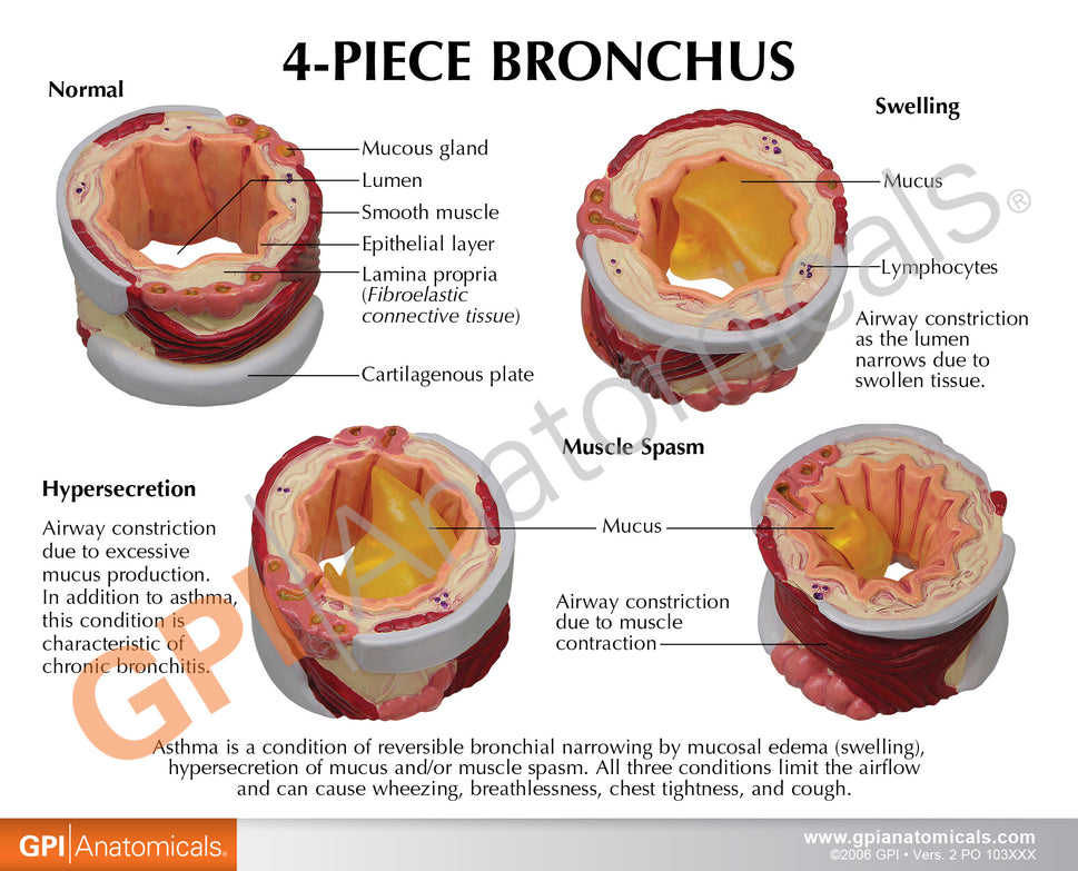 Bronchus Model (4 stages)