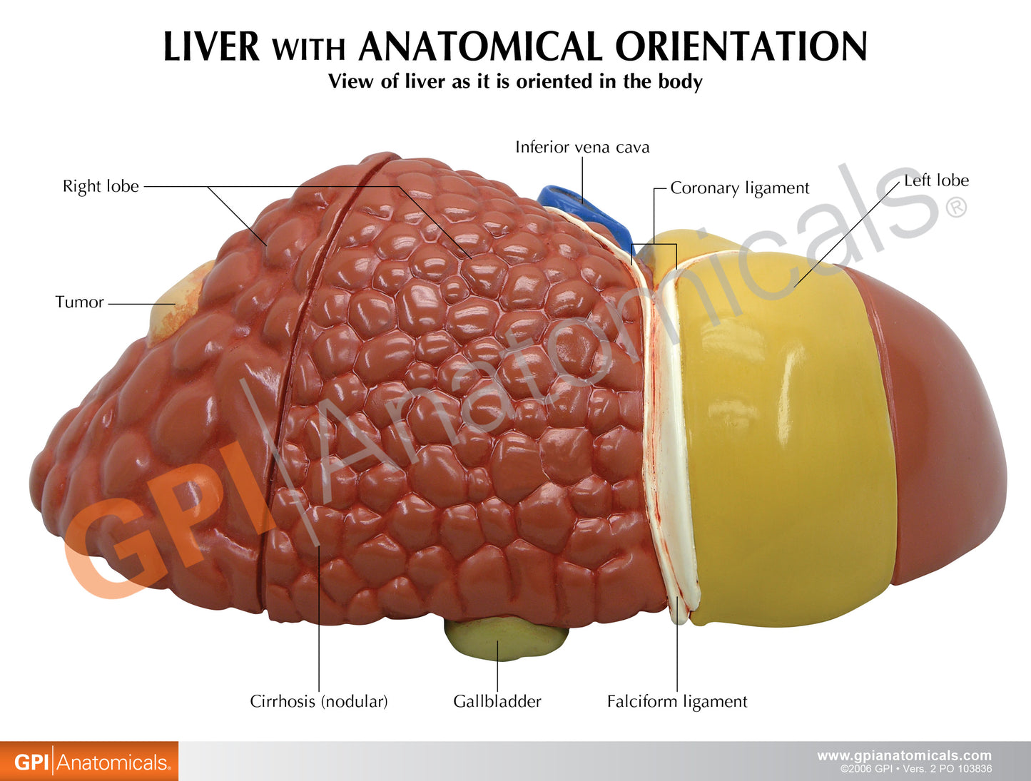 Liver Model with Pathologies 3310 card back