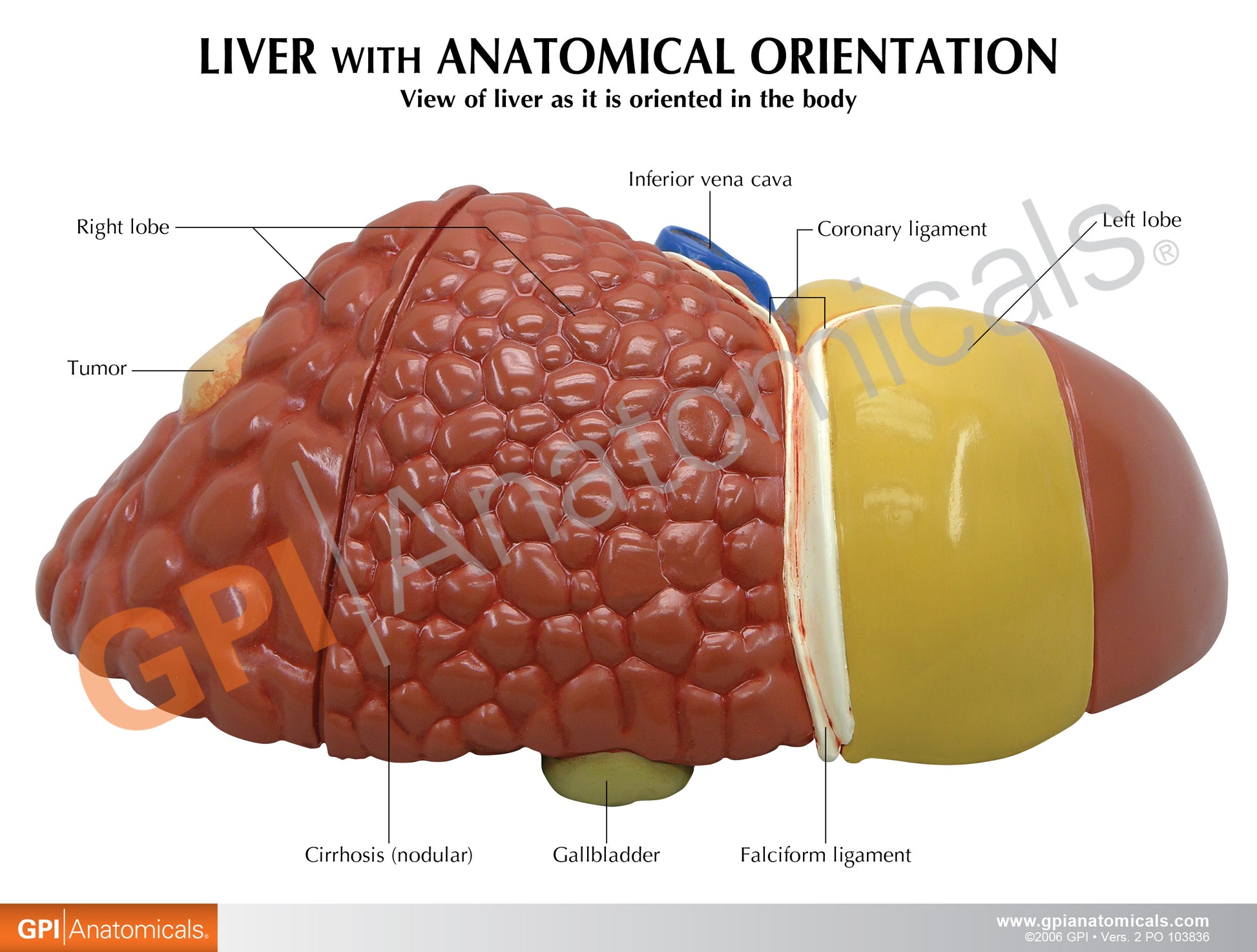 Liver Model with Pathologies