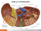 Switch Liver Model with Pathologies 3310 card front 2 image