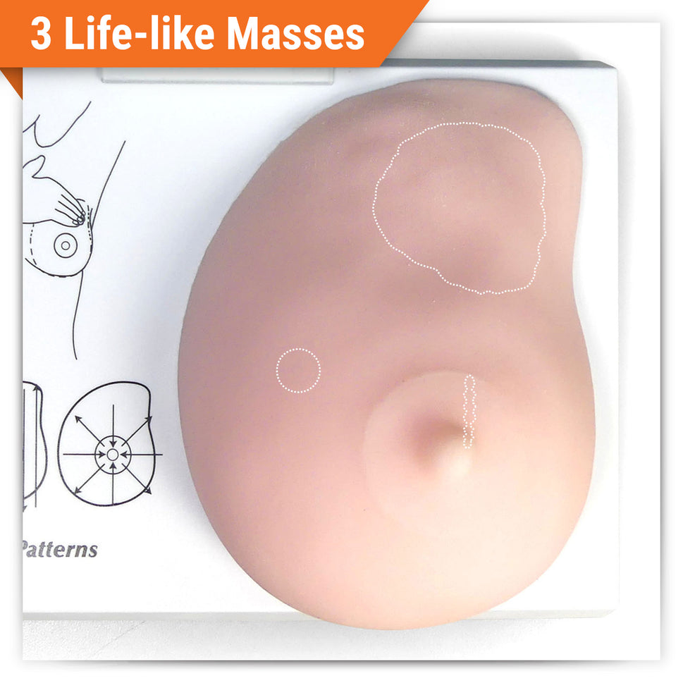Breast Cancer Anatomical Model