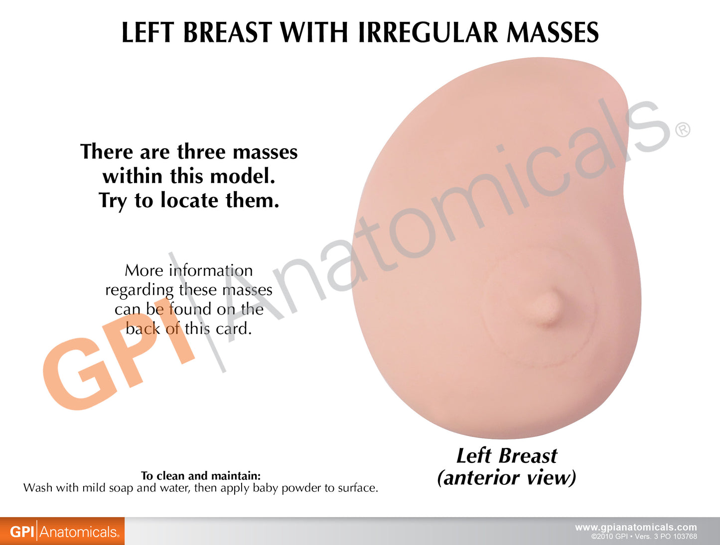 Breast Cancer Anatomical Model