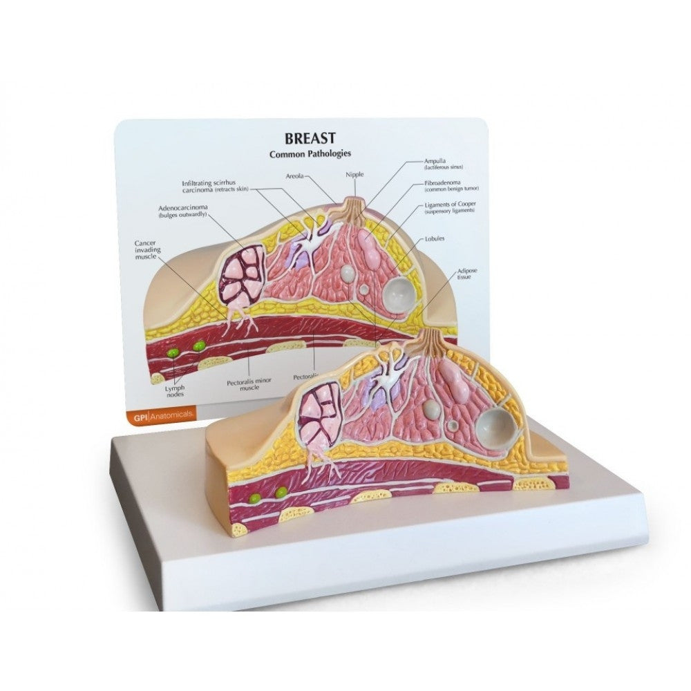 Breast Anatomy & Pathology Collection