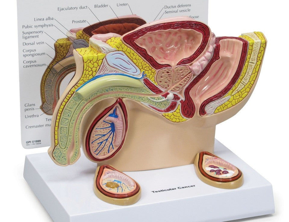 Male Pelvis Section Model with Testicular Cancer