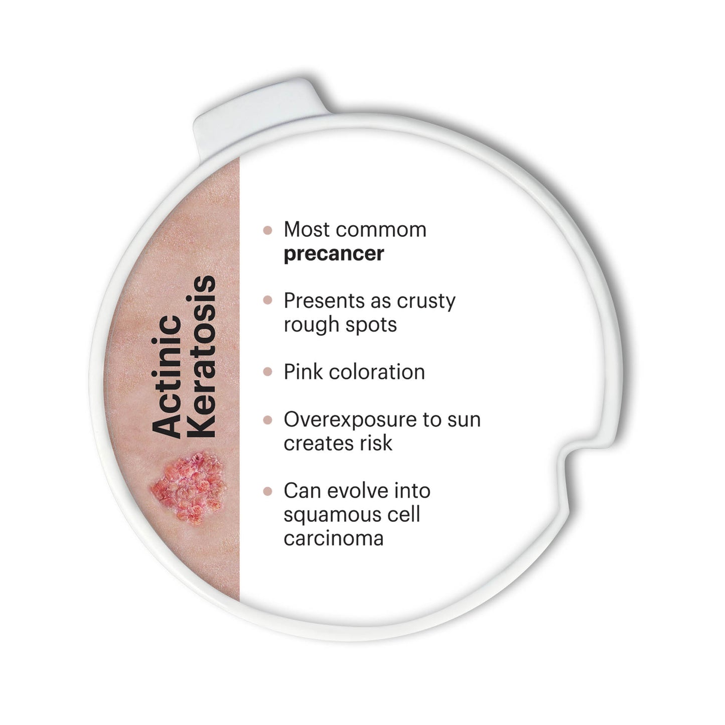 Precancerous and Cancerous Skin Lesions Disk Set 3851 AK back