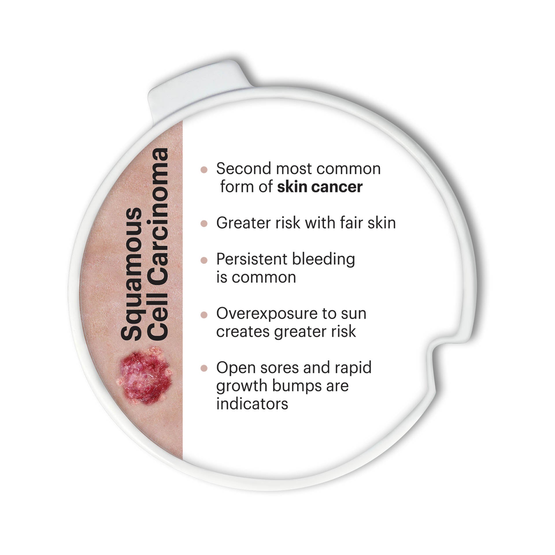 Precancerous and Cancerous Skin Lesions Disk Set