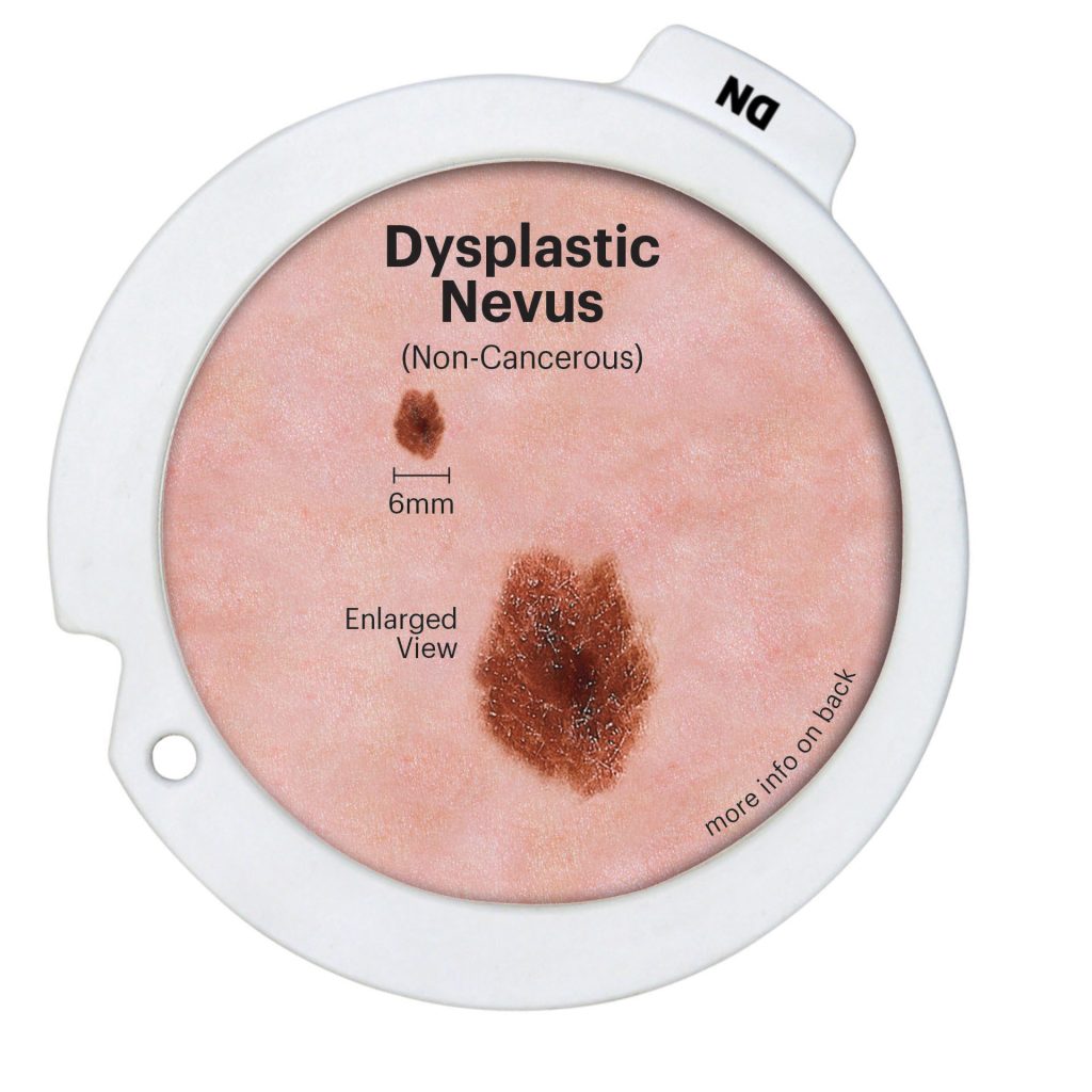 Precancerous and Cancerous Skin Lesions Disk Set 3851 DN front