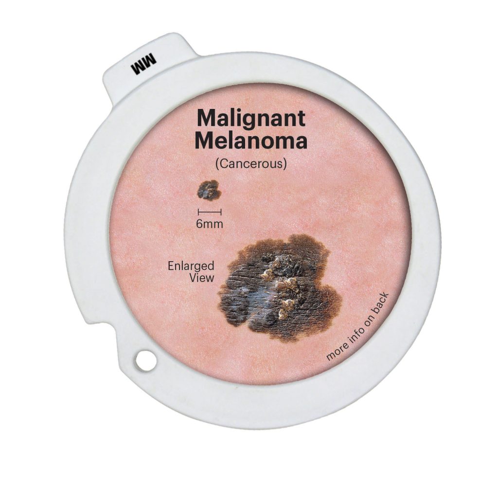 Precancerous and Cancerous Skin Lesions Disk Set 3851 MM front