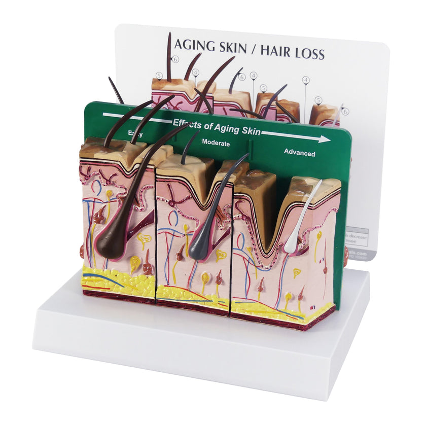 Aging Skin and Hair Loss Model 3900 model and card