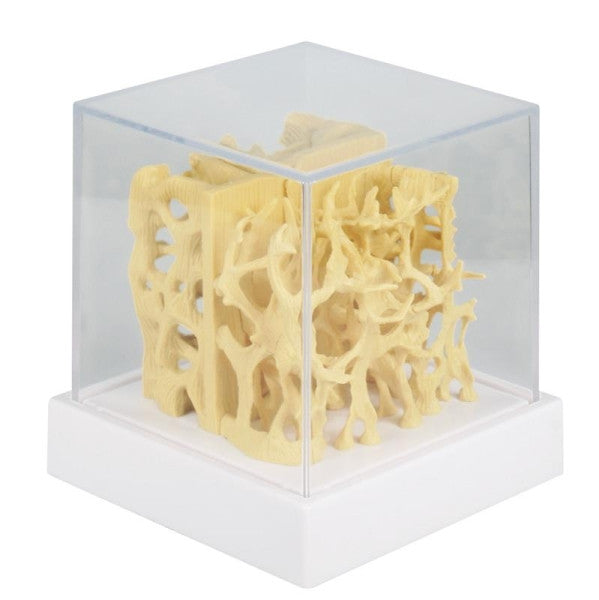 Healthy/Osteoporotic Bone Structure Model