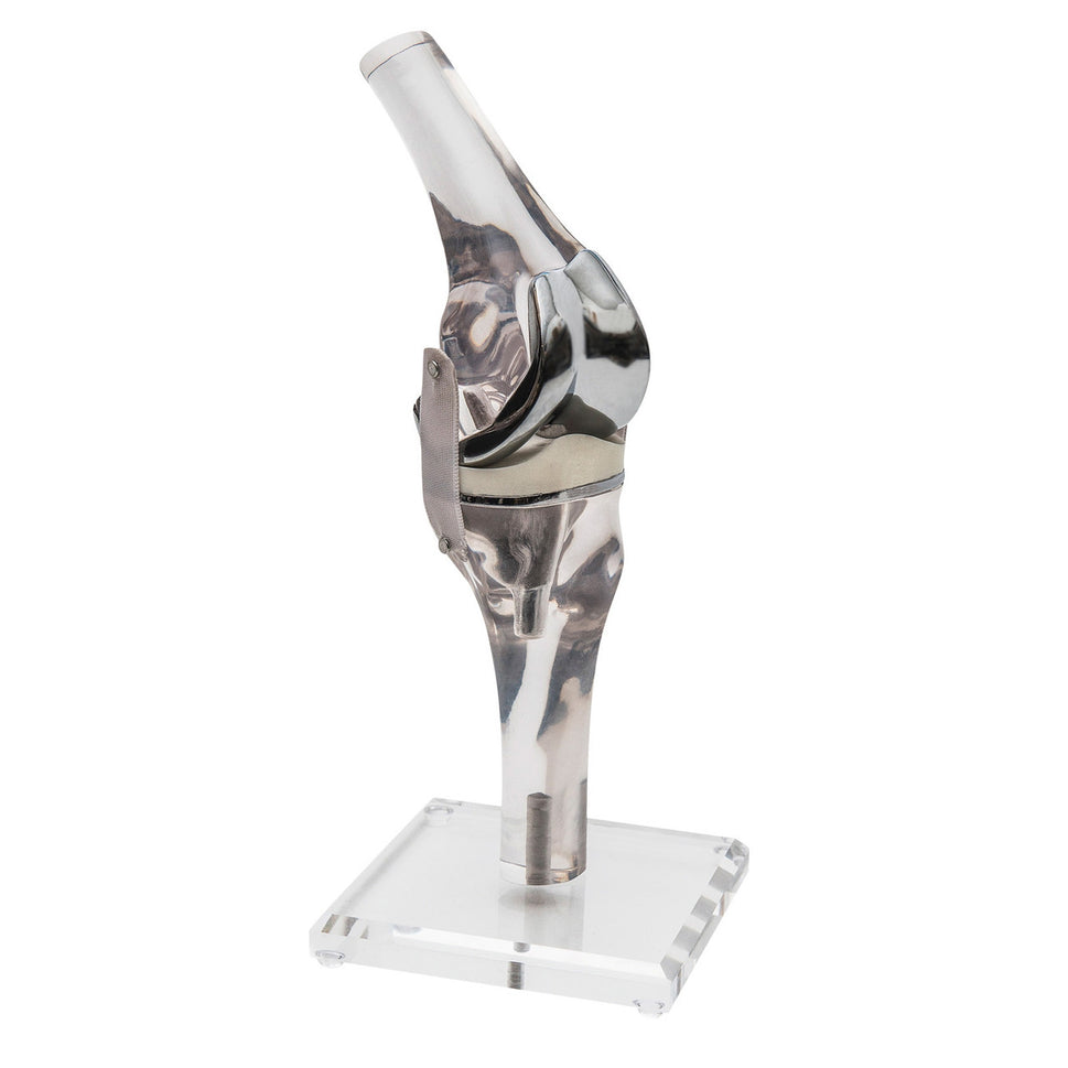Knee Replacement Model
