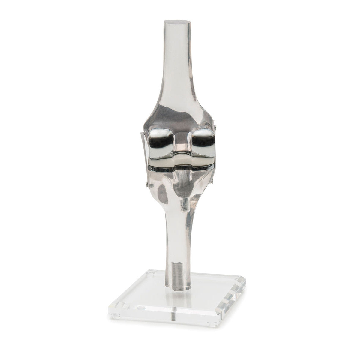 Knee Replacement Model