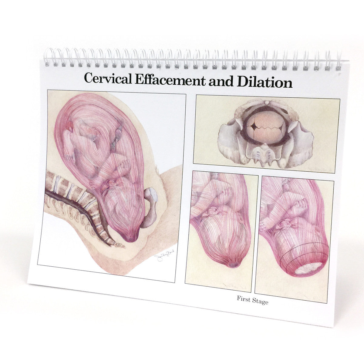Cervical Effacement and Dilation Flip Chart