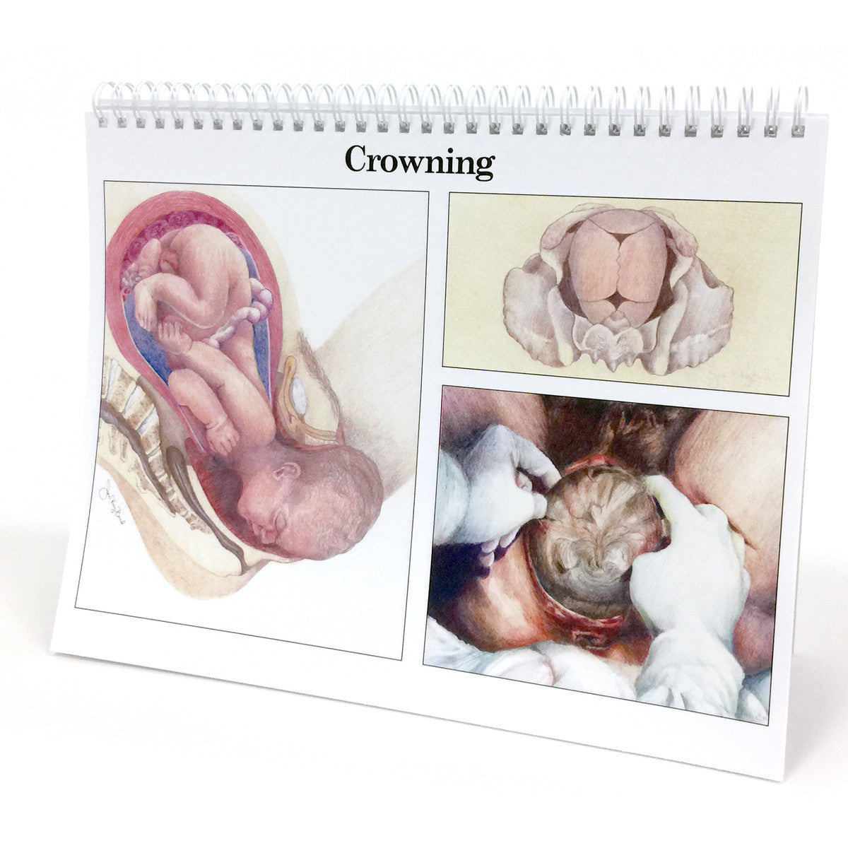 Pregnancy and Labour - Crowning - Pregnancy Education Flip Chart