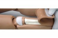 Intraosseous Infusion Site of Paediatric Patient