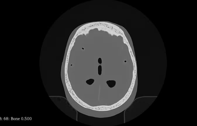Adult Head (Standard) for X-Ray CT, US, MRI HD-A03 image 12