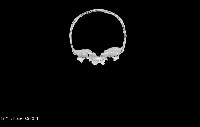 Adult Head (Standard) for X-Ray CT, US, MRI HD-A03 image 13