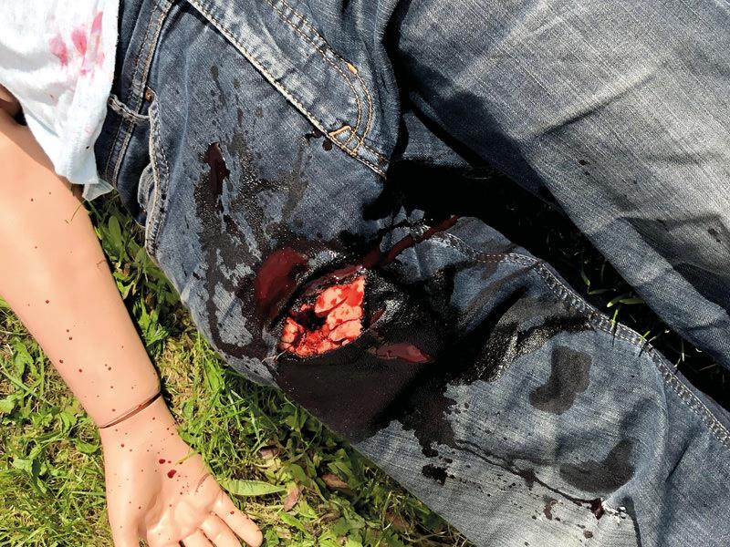 Wound Packing Trainer 7770 lifestyle images
