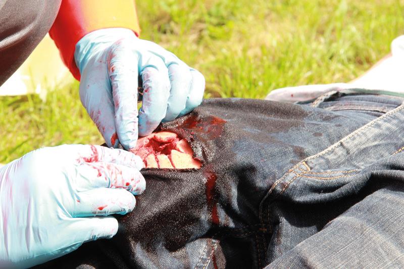 Wound Packing Trainer 7770 lifestyle image