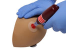 Switch Intraosseous Access Simulation on the Amy Arm Intraosseous Task Trainer 3 image