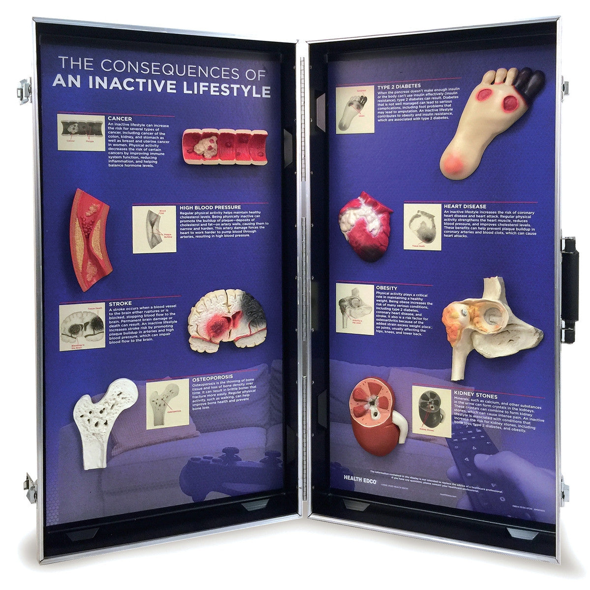 The Consequences Of An Inactive Lifestyle 3D Display