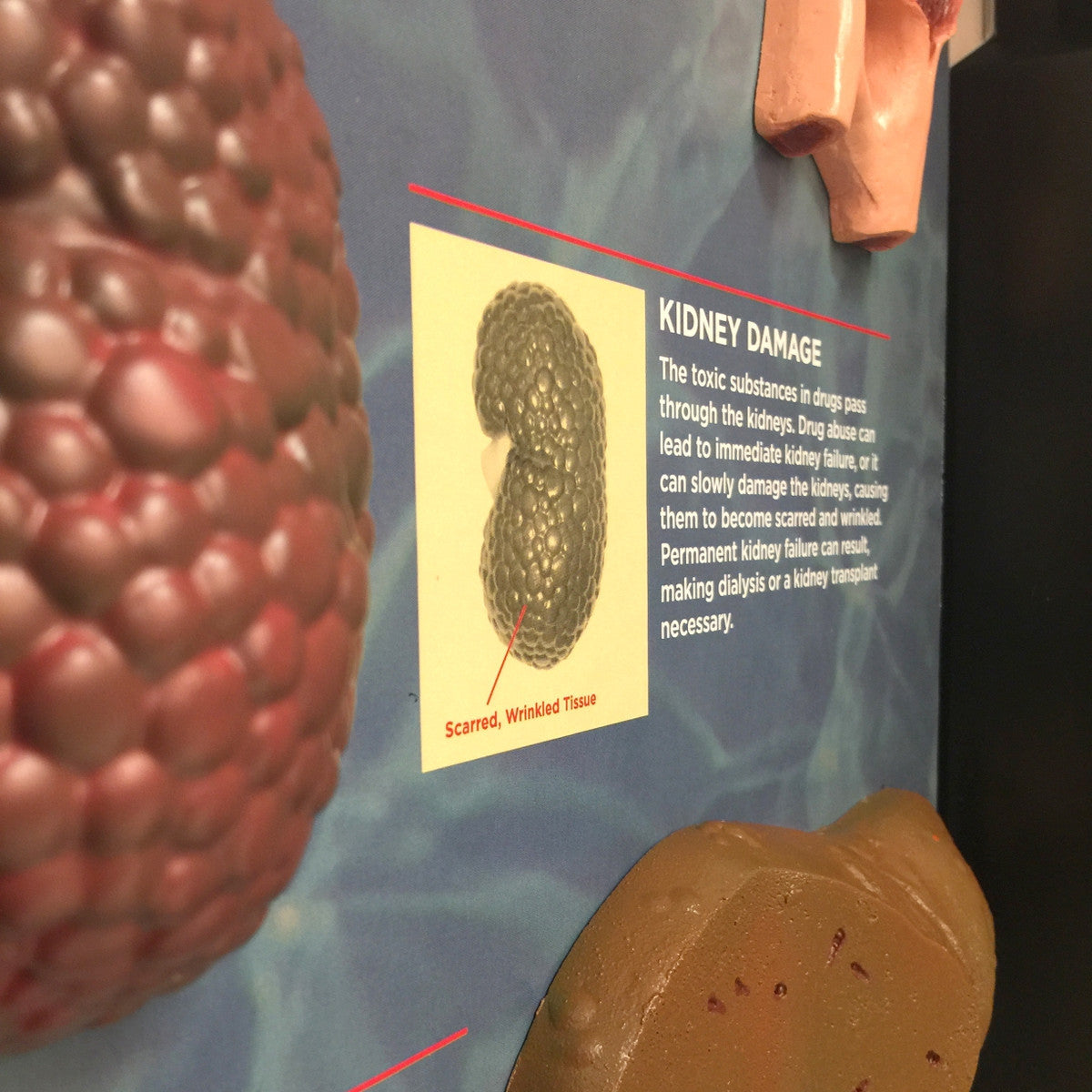The Consequences of Drug Abuse 3D Display 1