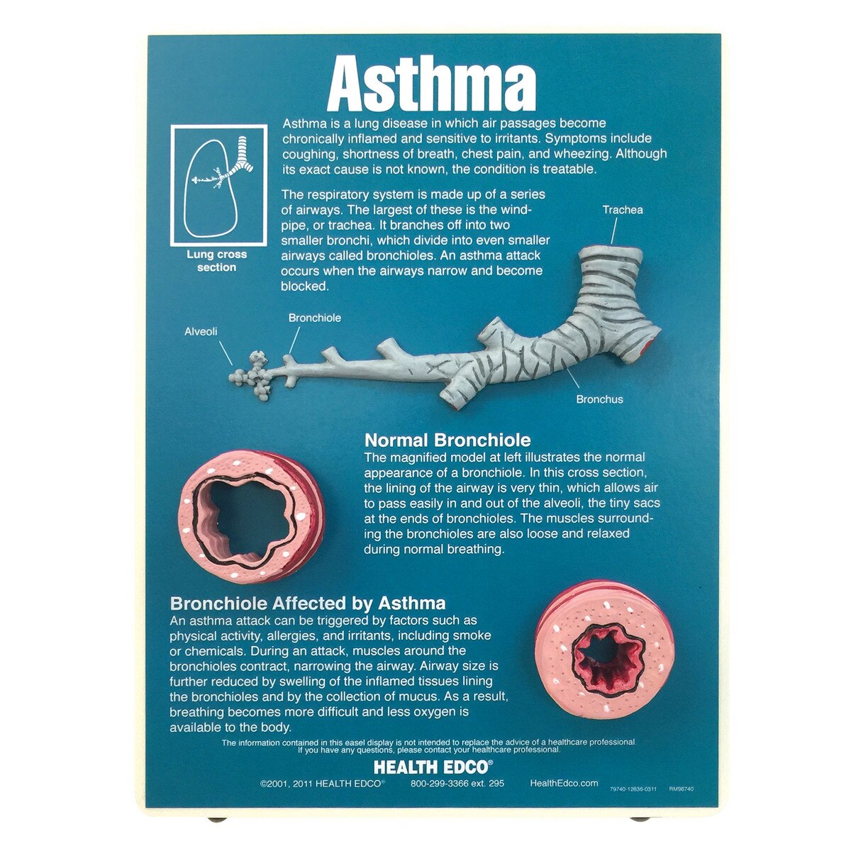 Asthma Easel Display