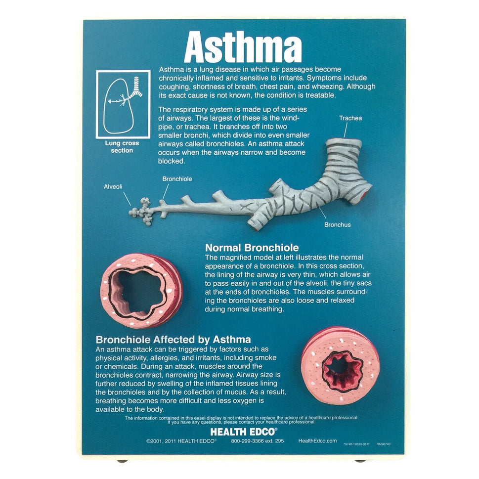 Asthma Easel Display